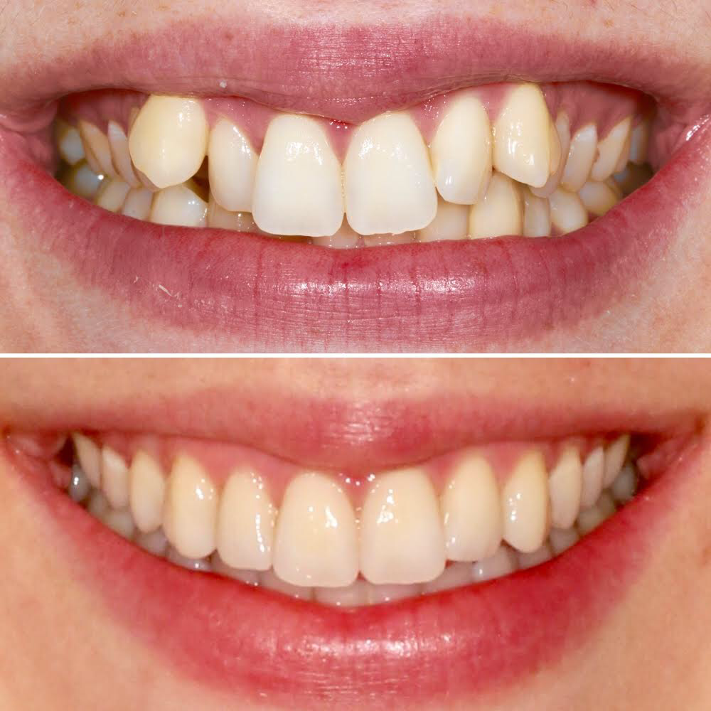 Claremont Dental | dentist | 322 Stirling Hwy, Claremont WA 6010, Australia | 0893831200 OR +61 8 9383 1200