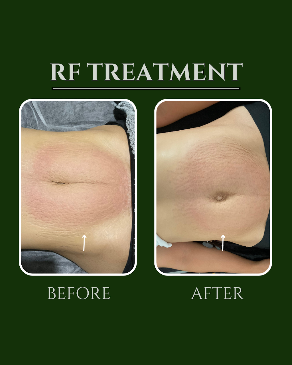 Bodiez By B | 5/141 Maudsland Rd, Oxenford QLD 4210, Australia | Phone: 0447 106 981