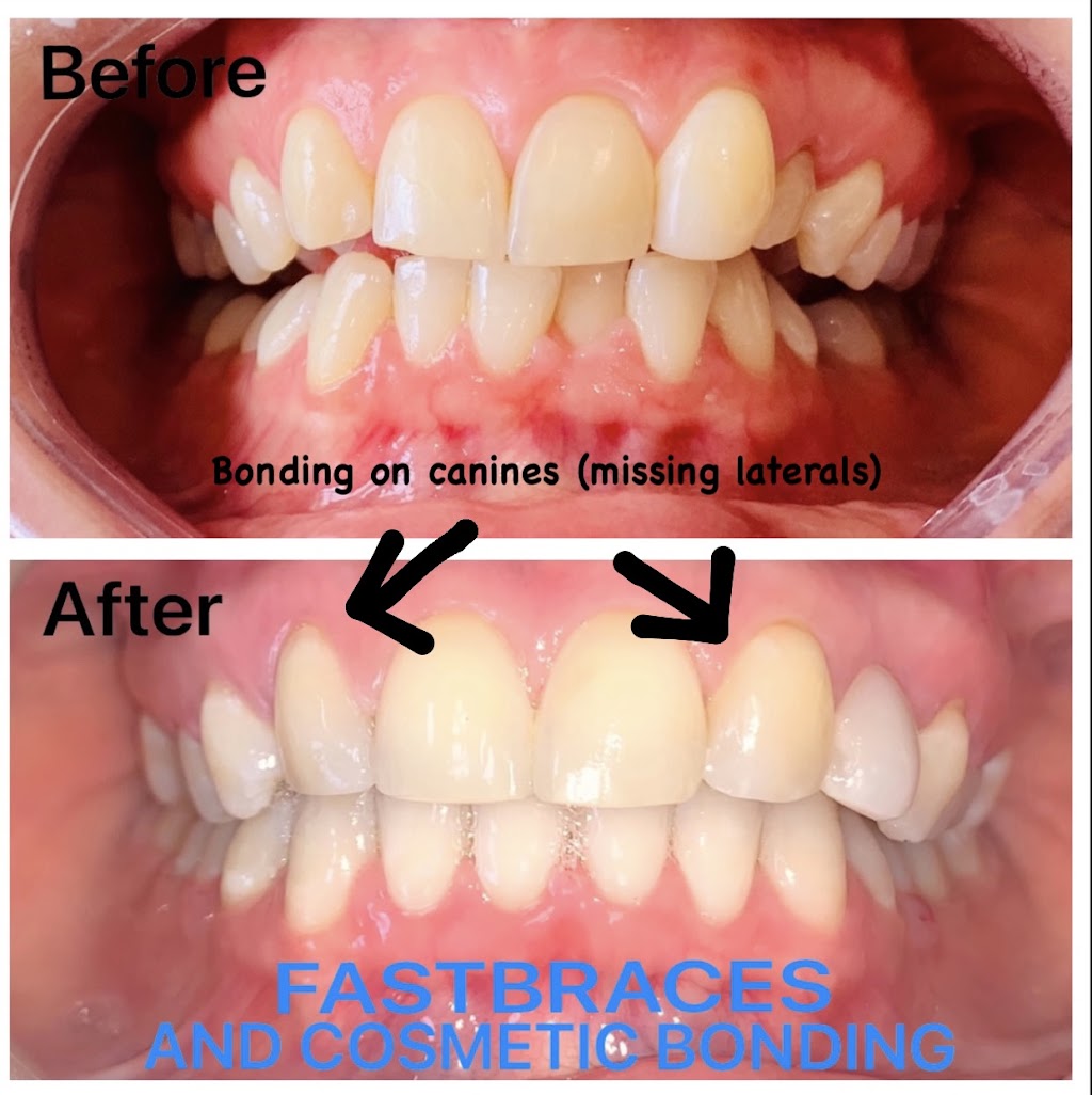 Smile Place - Tecoma Dental | dentist | 1586 Burwood Hwy, Tecoma VIC 3160, Australia | 0397542148 OR +61 3 9754 2148