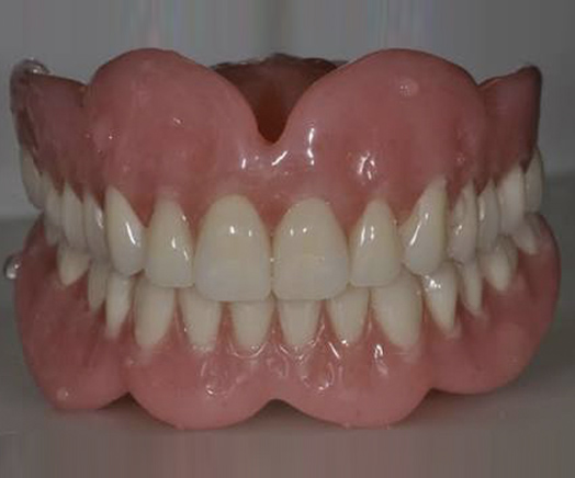 Australiawide Dental Lab Pty Ltd | dentist | 99 Wilkins St, Bankstown NSW 2200, Australia | 0413561931 OR +61 413 561 931